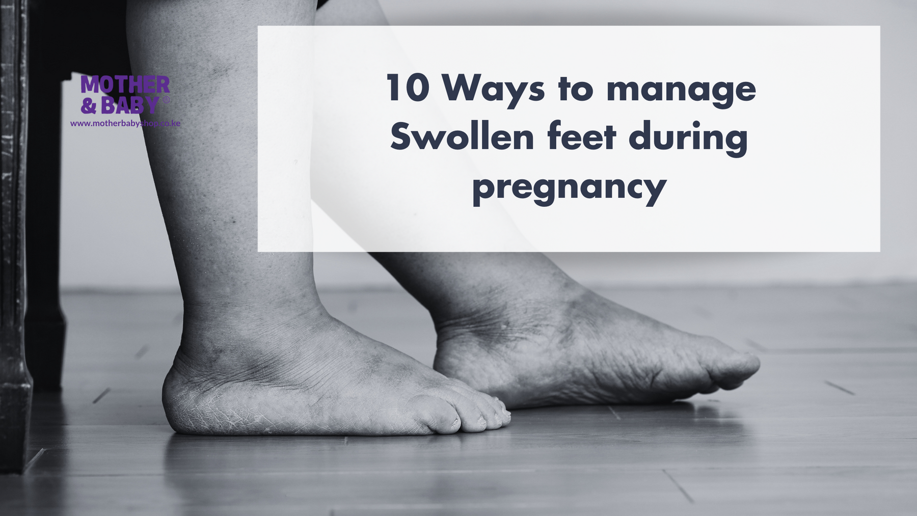 10 Ways to manage swollen feet during prgnancy