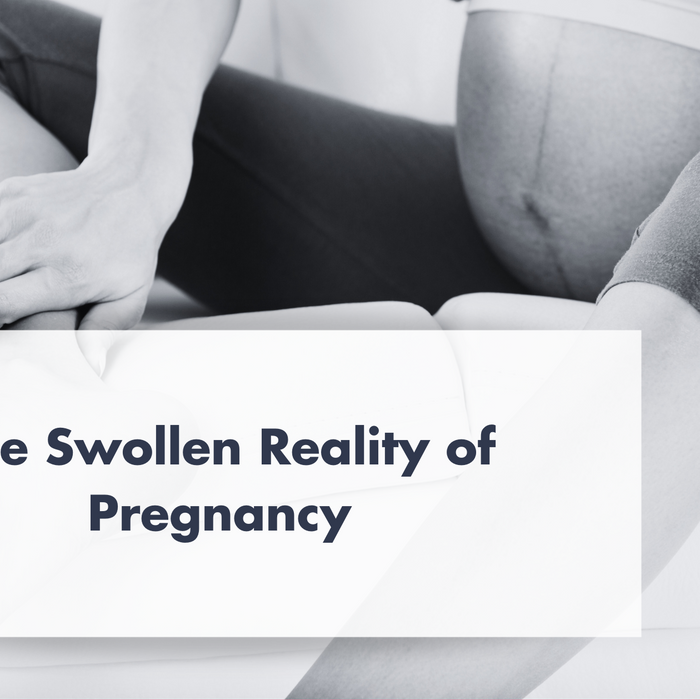 The Swollen Reality of Pregnancy